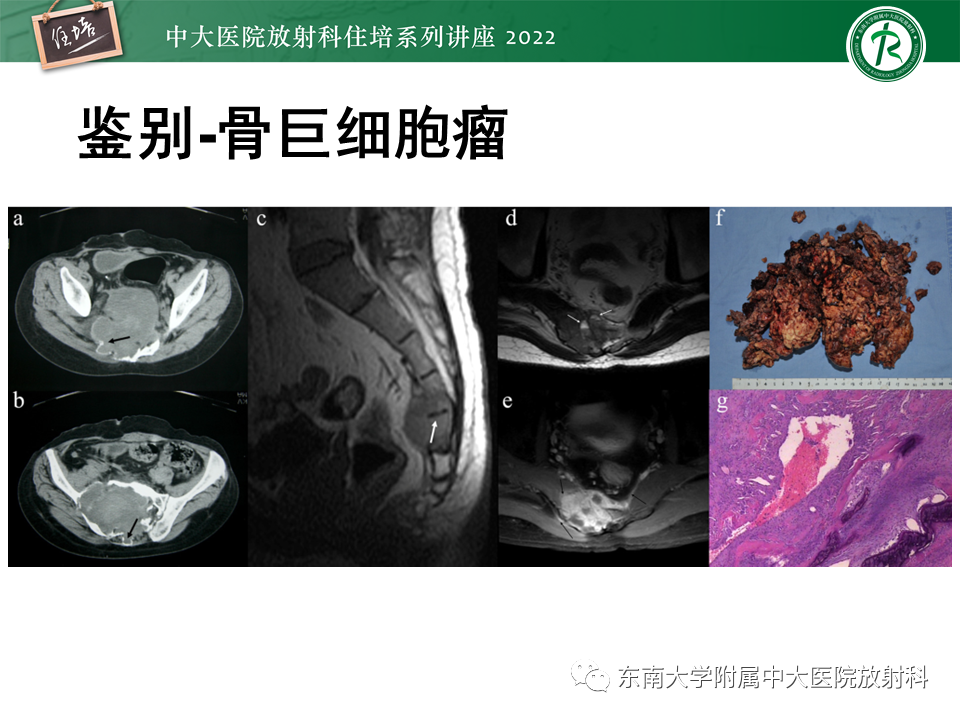影像PPT - 【PPT】常见椎体孤立性肿瘤的诊断思路-23