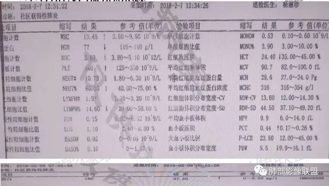 影像PPT - 【病例】肺部成这样，糖尿病惹的祸？-3