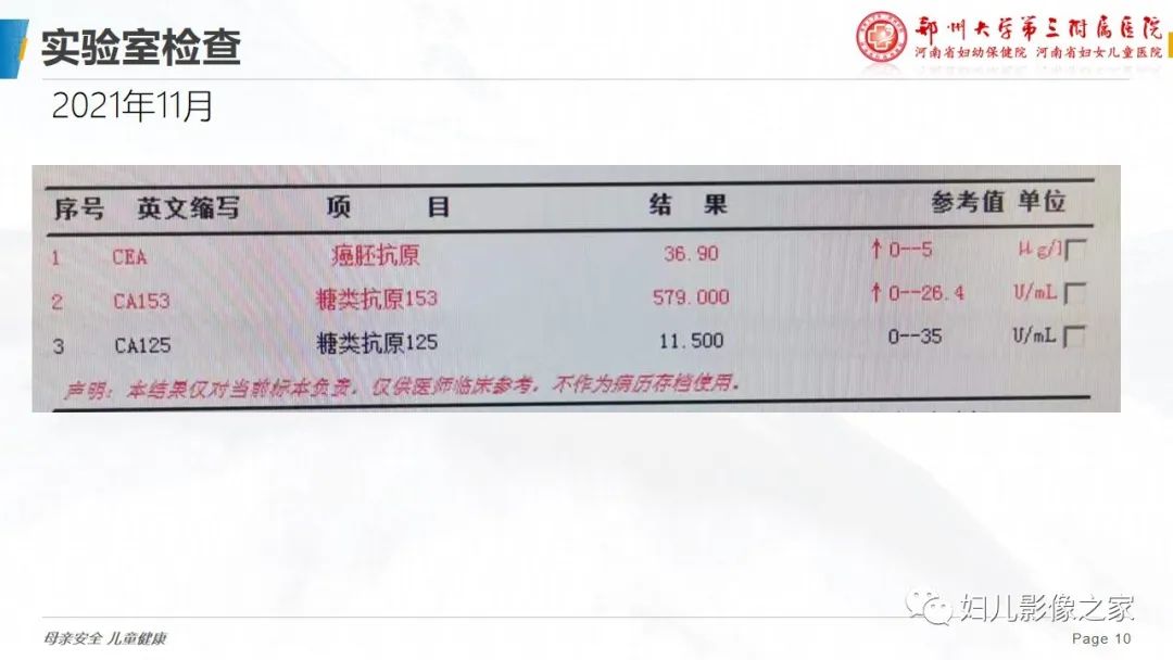 影像PPT - 【PPT】乳腺癌骨转移的假性进展-10