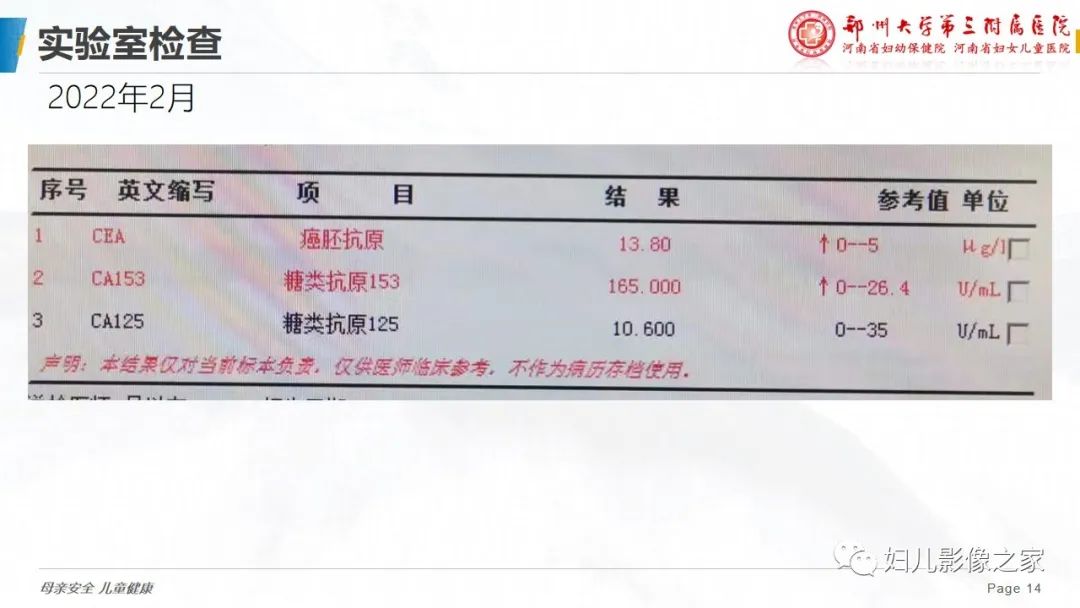影像PPT - 【PPT】乳腺癌骨转移的假性进展-14