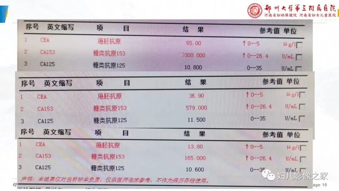 影像PPT - 【PPT】乳腺癌骨转移的假性进展-16