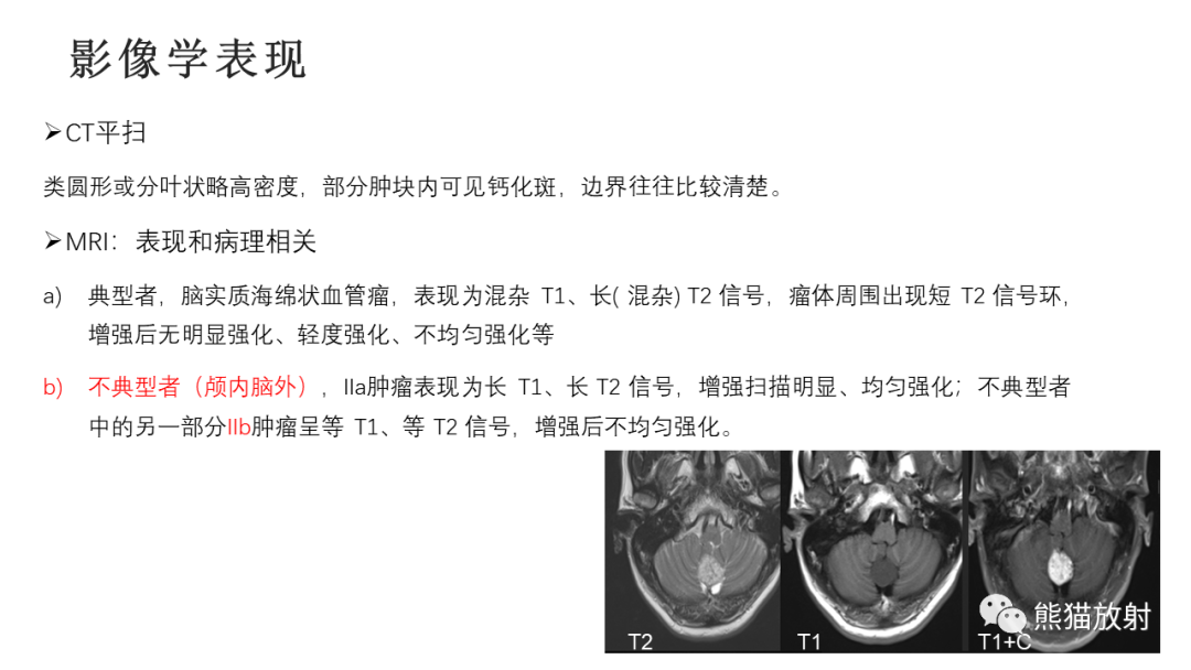 影像PPT - 【病例】四脑室孤立性纤维瘤 VS 小脑蚓部海绵状血管瘤-34