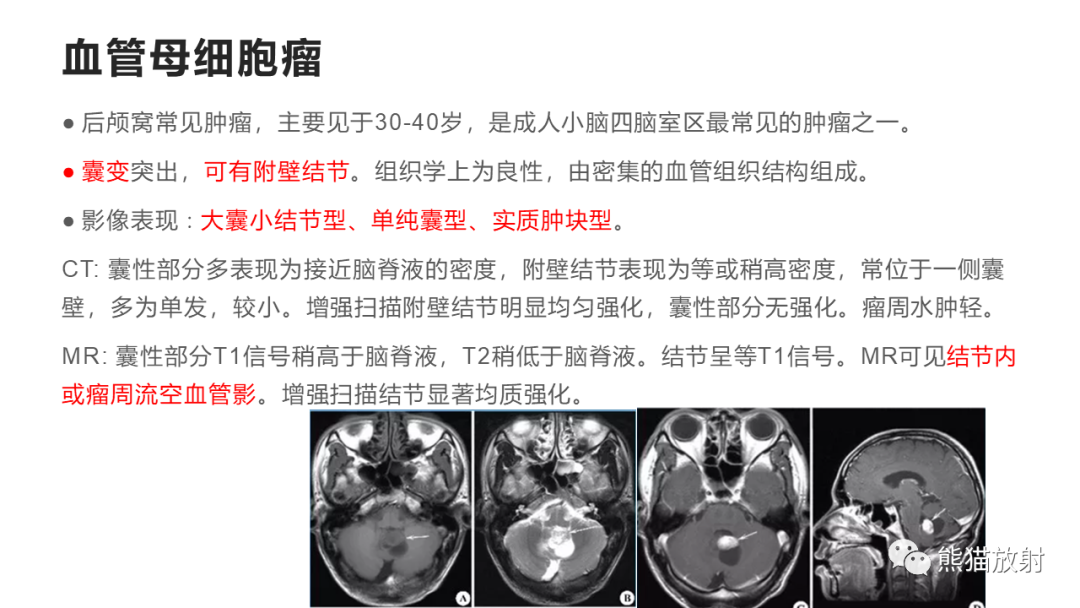 影像PPT - 【病例】四脑室孤立性纤维瘤 VS 小脑蚓部海绵状血管瘤-37
