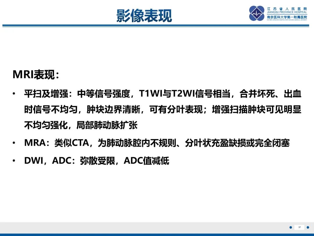 影像PPT - 【PPT】肺动脉内膜肉瘤-38