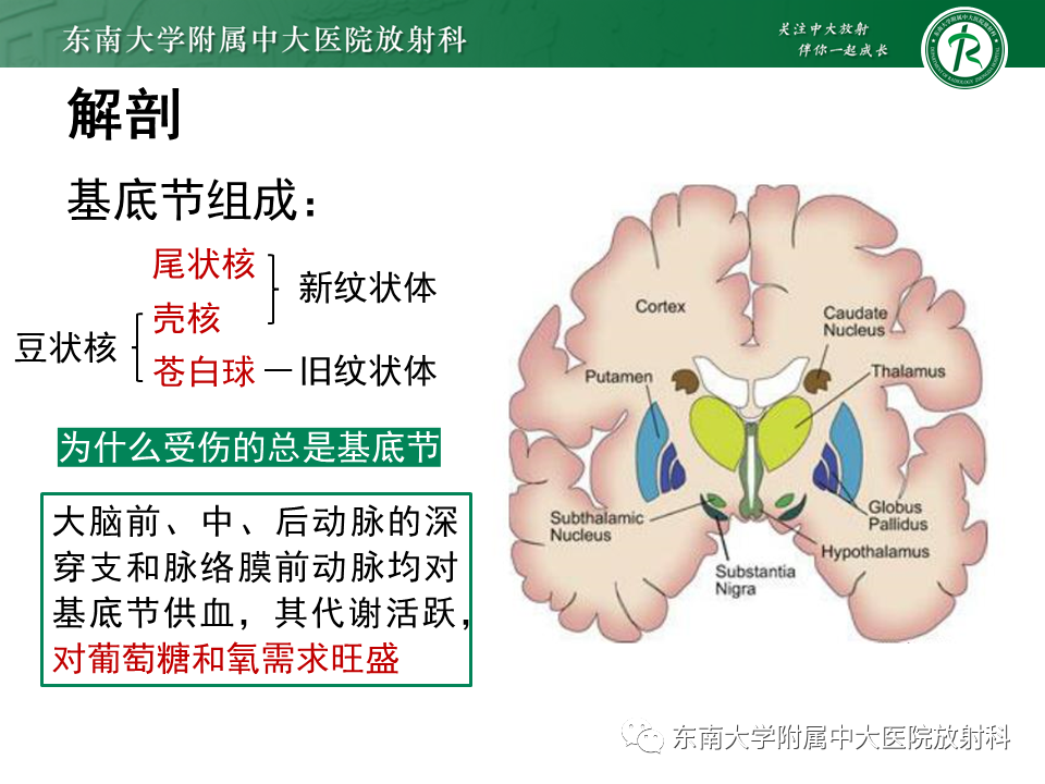 影像PPT - 【PPT】双基底节区病变影像诊断-17