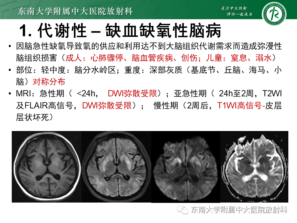 影像PPT - 【PPT】双基底节区病变影像诊断-21