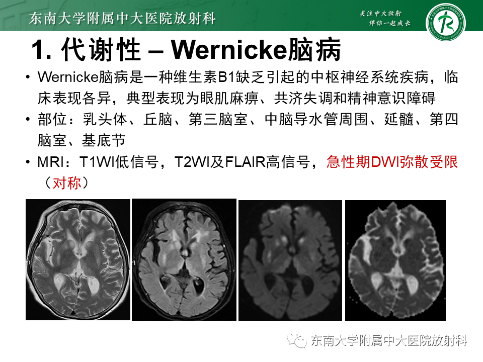影像PPT - 【PPT】双基底节区病变影像诊断-22