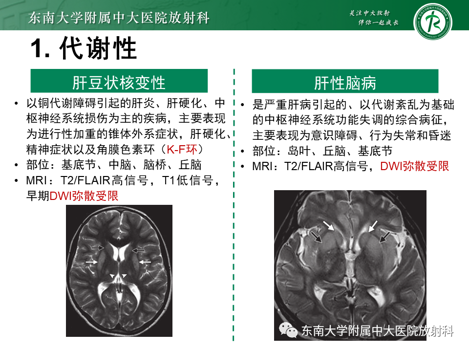 影像PPT - 【PPT】双基底节区病变影像诊断-25