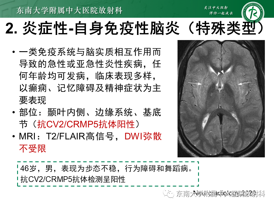 影像PPT - 【PPT】双基底节区病变影像诊断-27