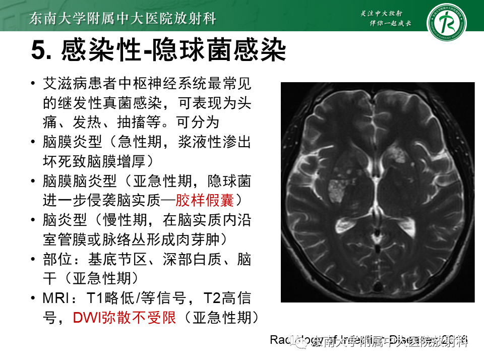 影像PPT - 【PPT】双基底节区病变影像诊断-31