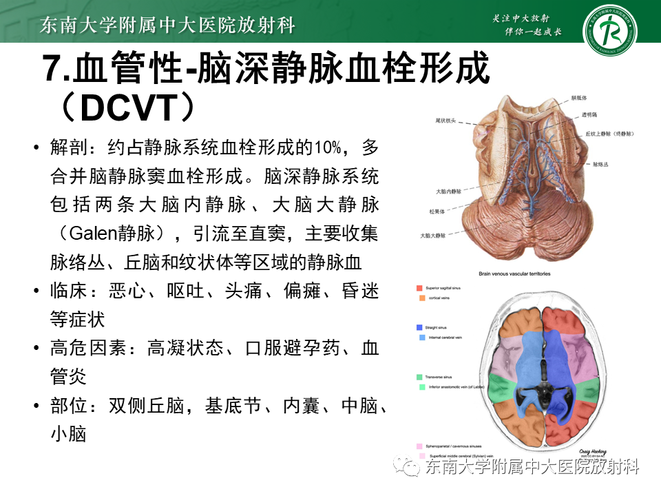 影像PPT - 【PPT】双基底节区病变影像诊断-35