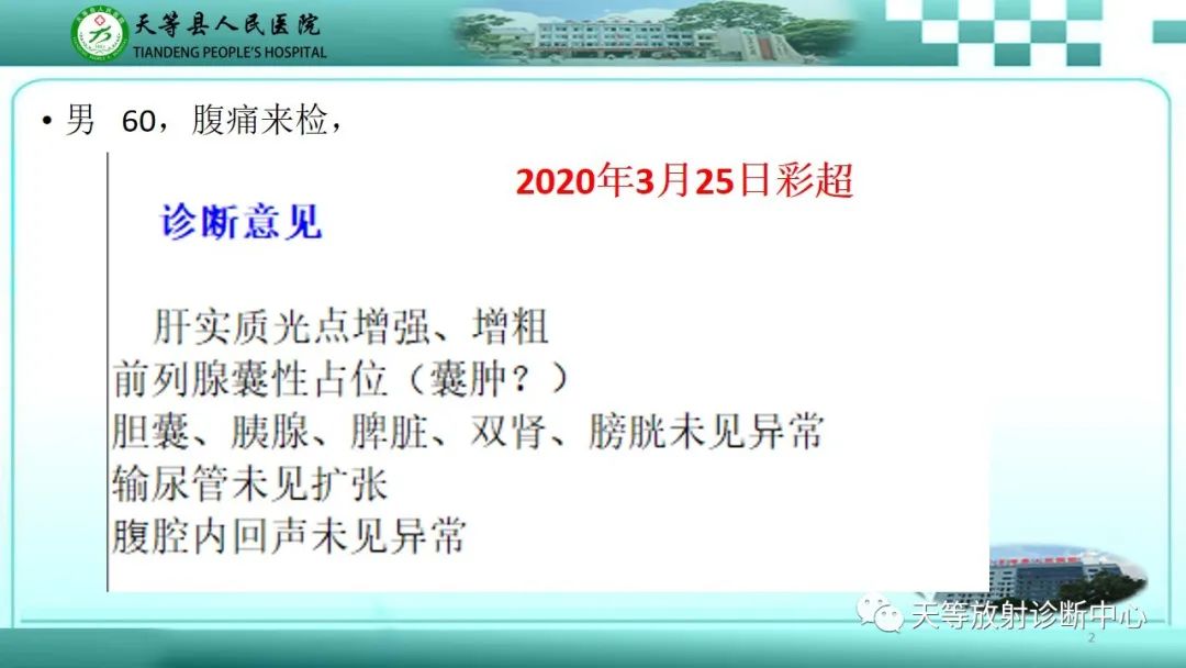 影像PPT - 【病例】脾脏假性动脉瘤1例CT影像-2 影像PPT - 【病例】脾脏假性动脉瘤1例CT影像-2