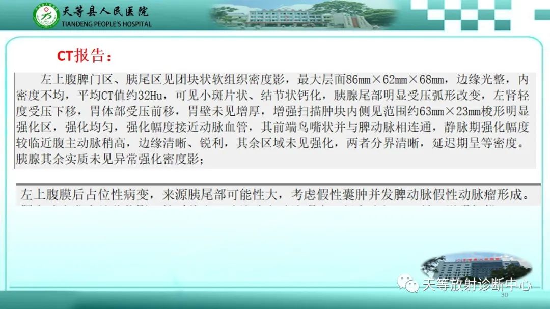 影像PPT - 【病例】脾脏假性动脉瘤1例CT影像-30 影像PPT - 【病例】脾脏假性动脉瘤1例CT影像-30