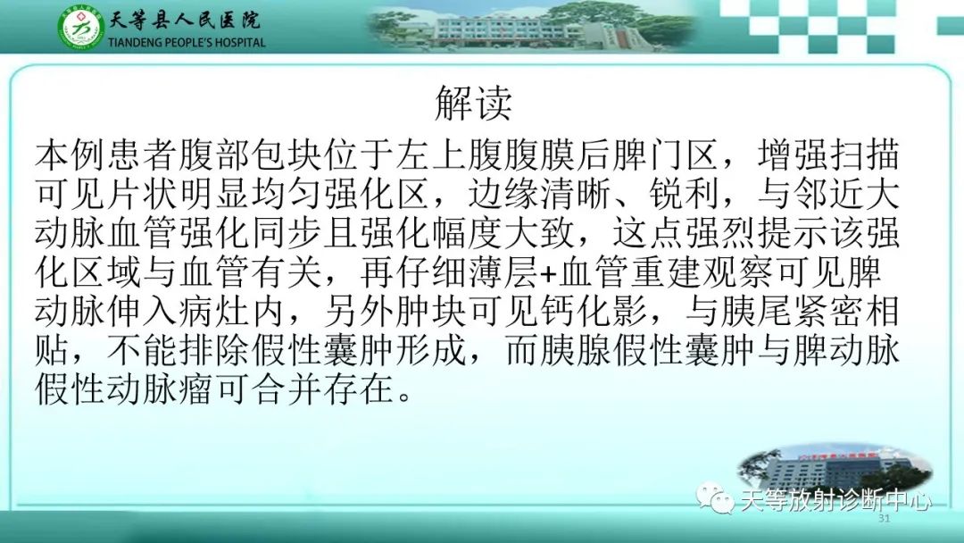 影像PPT - 【病例】脾脏假性动脉瘤1例CT影像-31 影像PPT - 【病例】脾脏假性动脉瘤1例CT影像-31