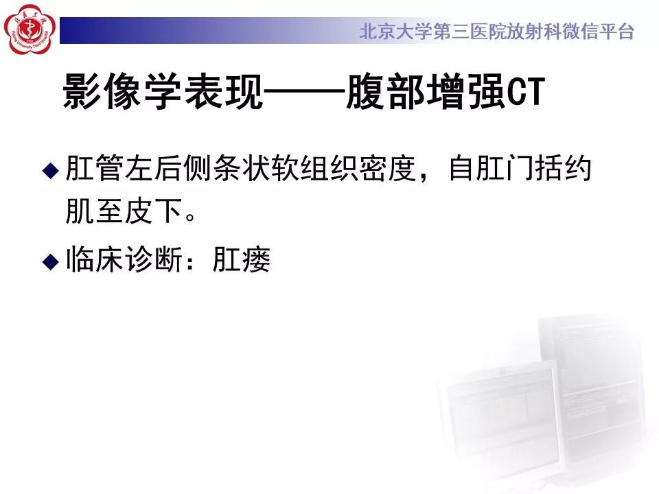 影像PPT - 【PPT】肛瘘-2