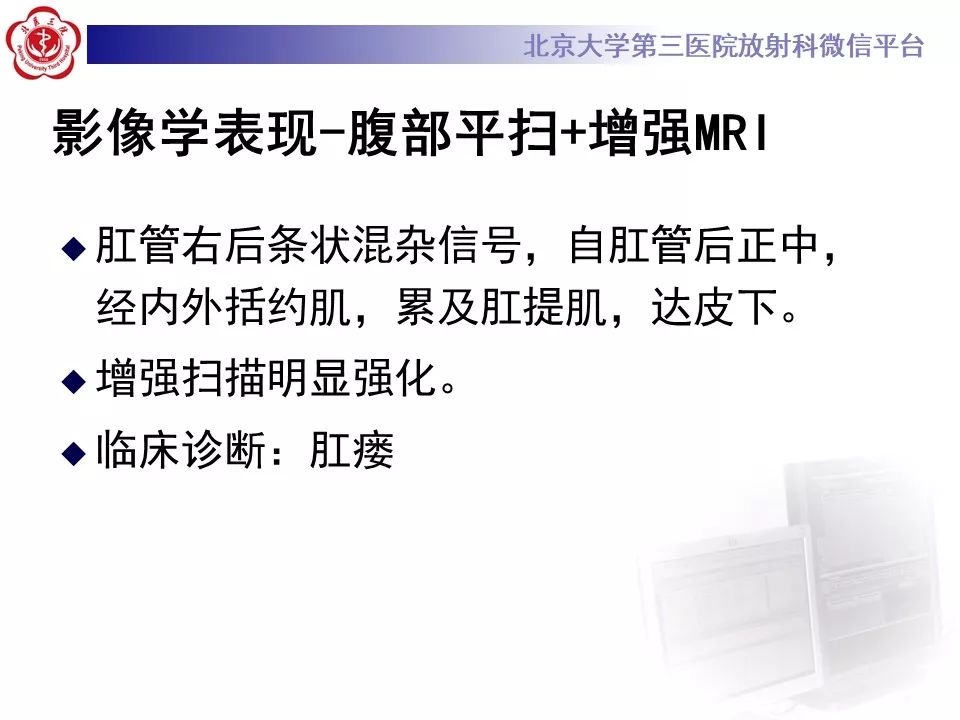 影像PPT - 【PPT】肛瘘-7