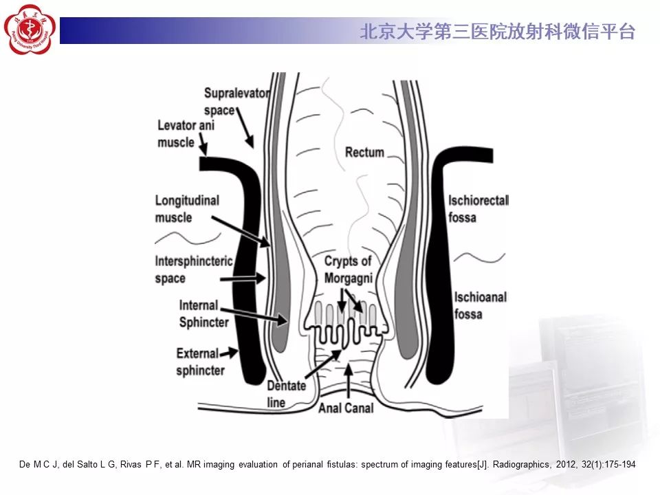 影像PPT - 【PPT】肛瘘-16