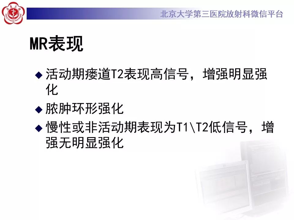 影像PPT - 【PPT】肛瘘-20