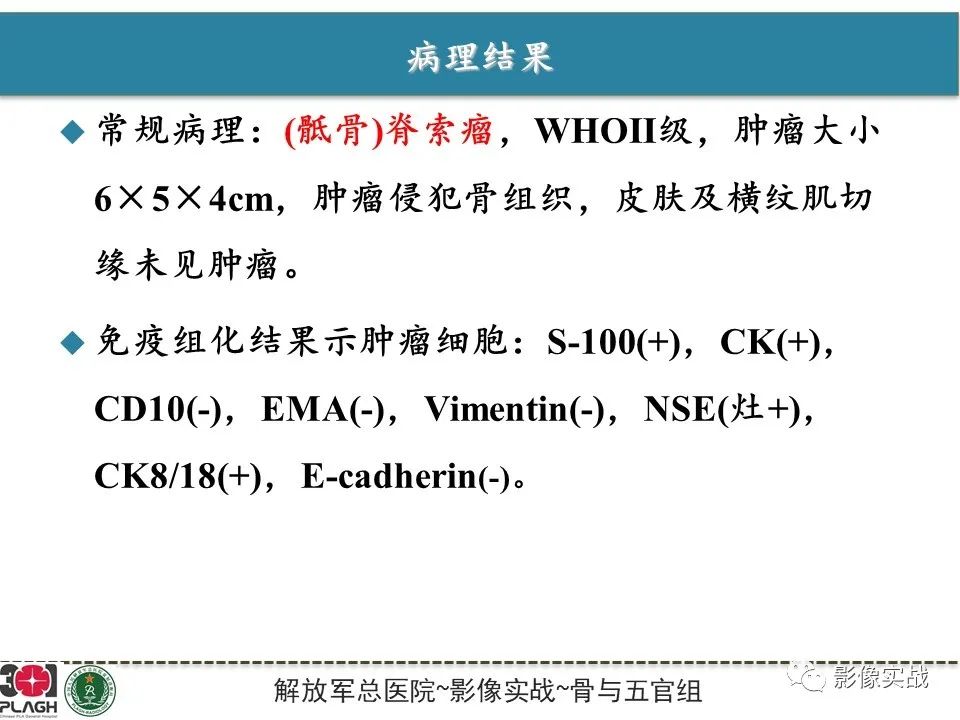 影像PPT - 【病例】骶尾部脊索瘤1例MR影像-9