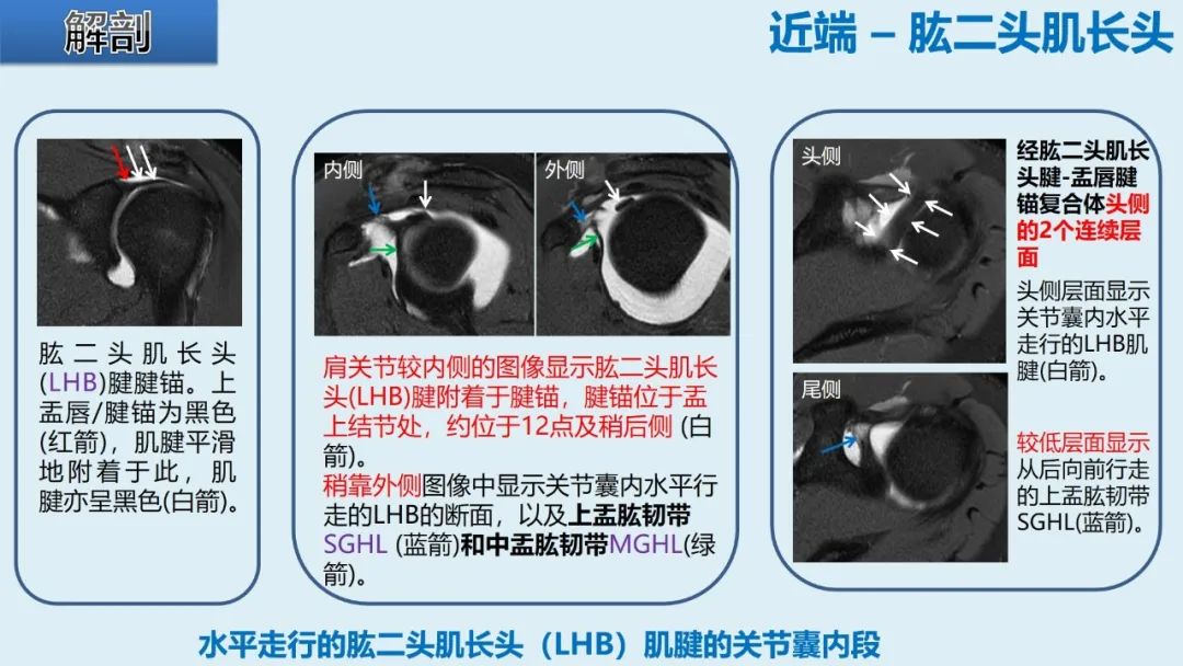 影像PPT - 【PPT】肱二头肌解剖、临床体征及损伤的影像表现-6 影像PPT - 【PPT】肱二头肌解剖、临床体征及损伤的影像表现-6