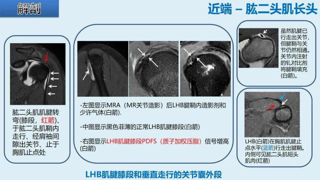 影像PPT - 【PPT】肱二头肌解剖、临床体征及损伤的影像表现-8 影像PPT - 【PPT】肱二头肌解剖、临床体征及损伤的影像表现-8