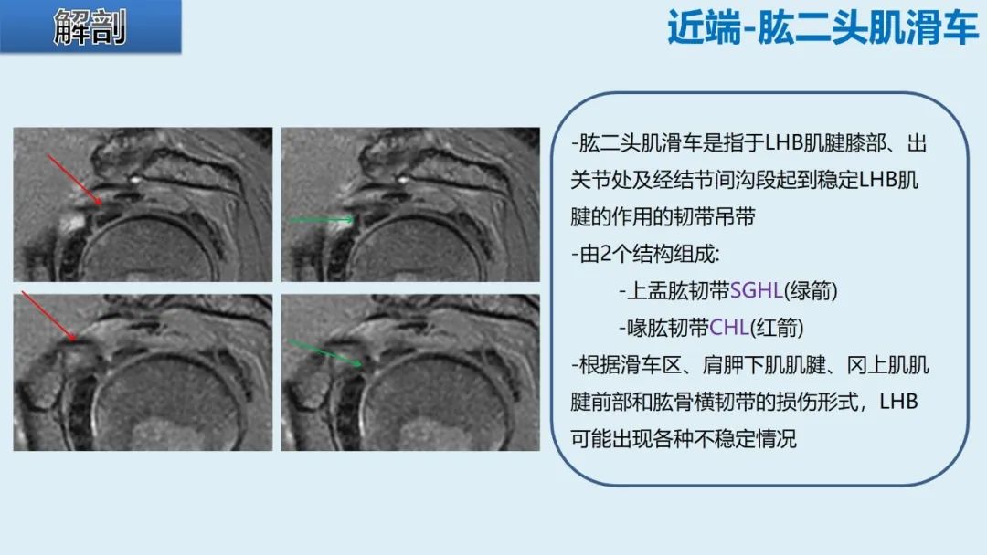 影像PPT - 【PPT】肱二头肌解剖、临床体征及损伤的影像表现-10 影像PPT - 【PPT】肱二头肌解剖、临床体征及损伤的影像表现-10