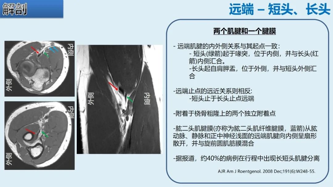 影像PPT - 【PPT】肱二头肌解剖、临床体征及损伤的影像表现-18 影像PPT - 【PPT】肱二头肌解剖、临床体征及损伤的影像表现-18