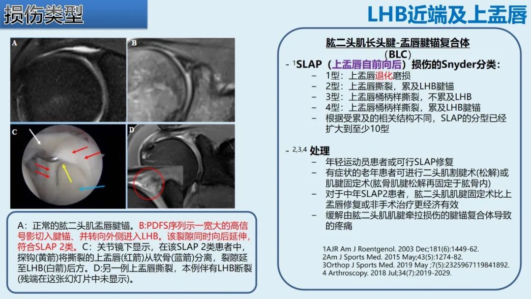 影像PPT - 【PPT】肱二头肌解剖、临床体征及损伤的影像表现-26 影像PPT - 【PPT】肱二头肌解剖、临床体征及损伤的影像表现-26