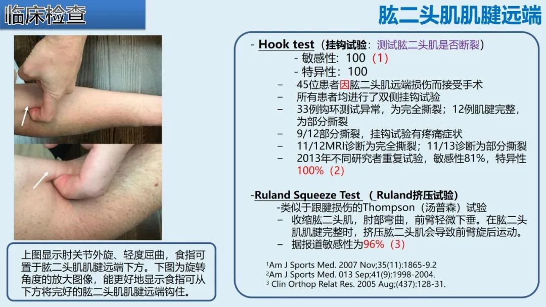 影像PPT - 【PPT】肱二头肌解剖、临床体征及损伤的影像表现-24 影像PPT - 【PPT】肱二头肌解剖、临床体征及损伤的影像表现-24