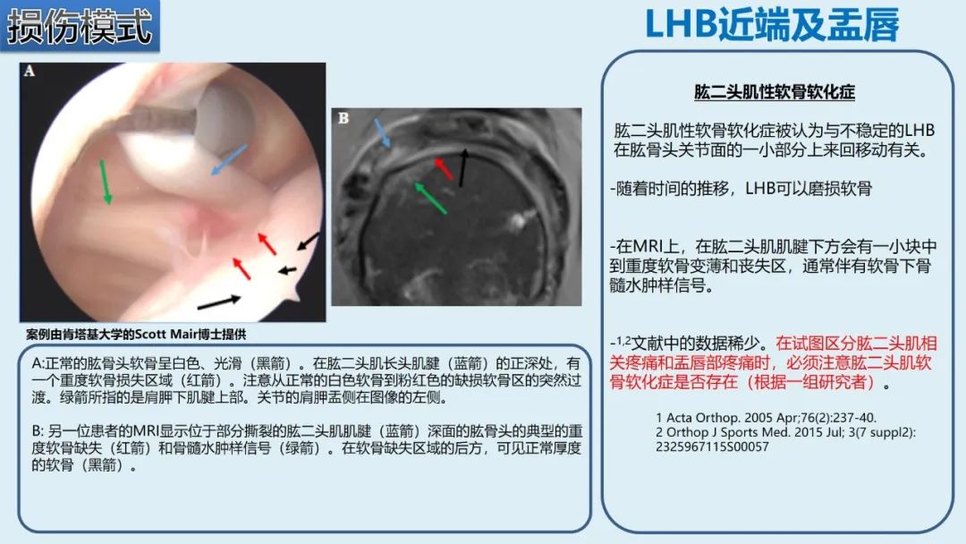 影像PPT - 【PPT】肱二头肌解剖、临床体征及损伤的影像表现-36 影像PPT - 【PPT】肱二头肌解剖、临床体征及损伤的影像表现-36