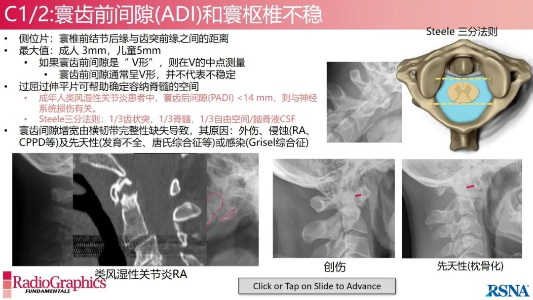 影像PPT - 【PPT】颈椎X线片解读-40 影像PPT - 【PPT】颈椎X线片解读-40