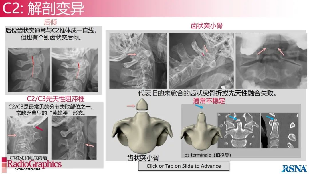 影像PPT - 【PPT】颈椎X线片解读-50 影像PPT - 【PPT】颈椎X线片解读-50