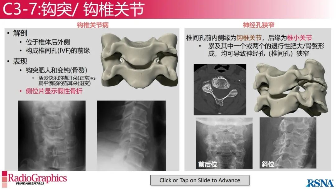 影像PPT - 【PPT】颈椎X线片解读-80 影像PPT - 【PPT】颈椎X线片解读-80