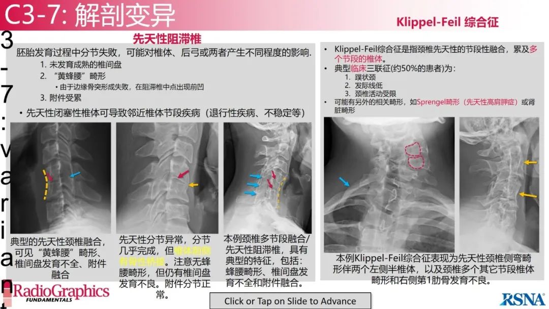 影像PPT - 【PPT】颈椎X线片解读-86 影像PPT - 【PPT】颈椎X线片解读-86
