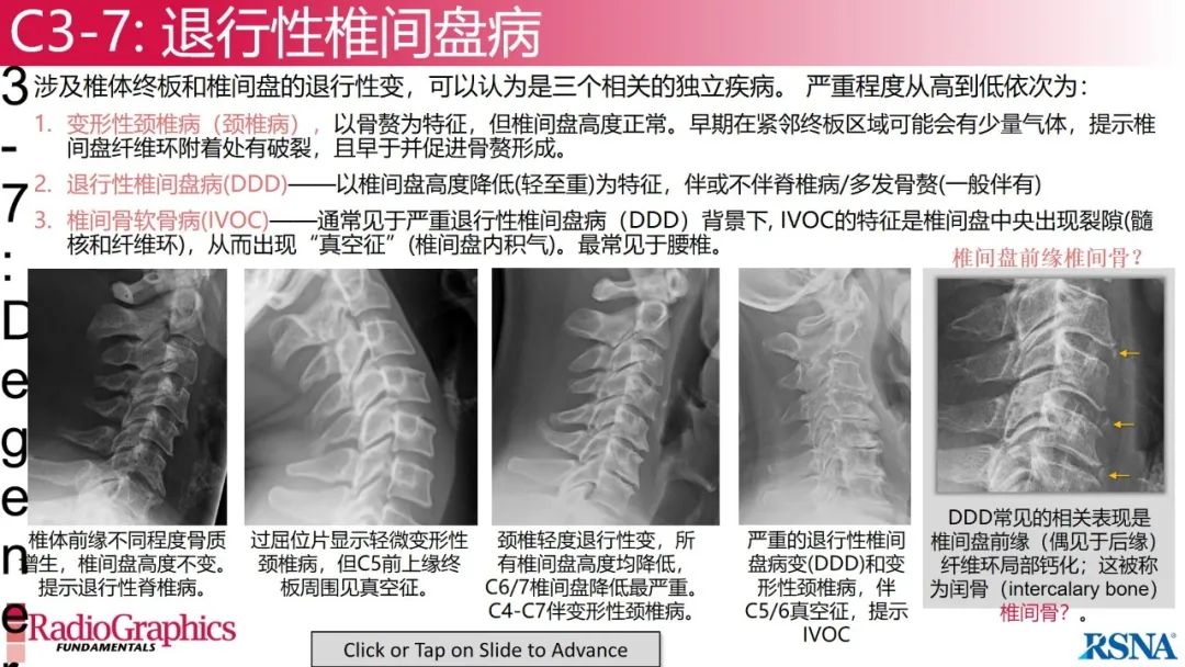 影像PPT - 【PPT】颈椎X线片解读-91 影像PPT - 【PPT】颈椎X线片解读-91