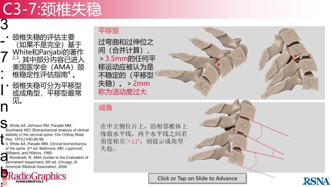 影像PPT - 【PPT】颈椎X线片解读-97 影像PPT - 【PPT】颈椎X线片解读-97