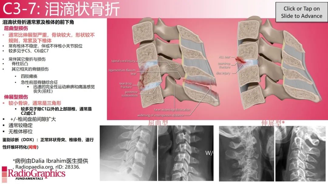影像PPT - 【PPT】颈椎X线片解读-99 影像PPT - 【PPT】颈椎X线片解读-99