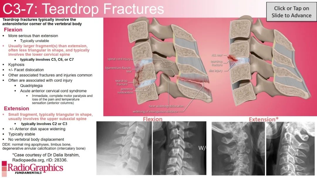 影像PPT - 【PPT】颈椎X线片解读-98 影像PPT - 【PPT】颈椎X线片解读-98