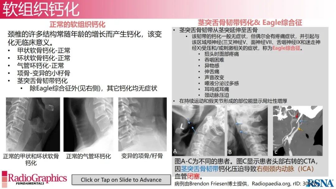 影像PPT - 【PPT】颈椎X线片解读-105 影像PPT - 【PPT】颈椎X线片解读-105