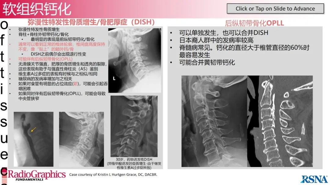 影像PPT - 【PPT】颈椎X线片解读-109 影像PPT - 【PPT】颈椎X线片解读-109