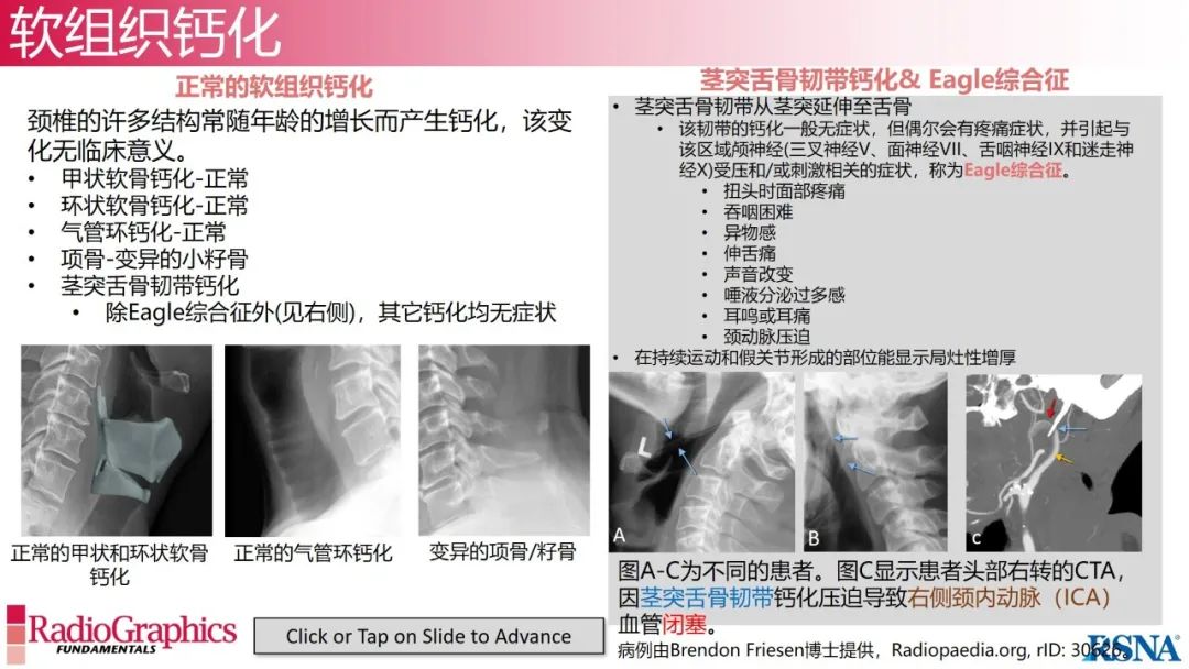 影像PPT - 【PPT】颈椎X线片解读-107 影像PPT - 【PPT】颈椎X线片解读-107