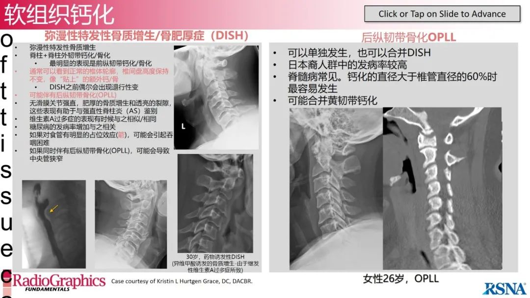 影像PPT - 【PPT】颈椎X线片解读-111 影像PPT - 【PPT】颈椎X线片解读-111
