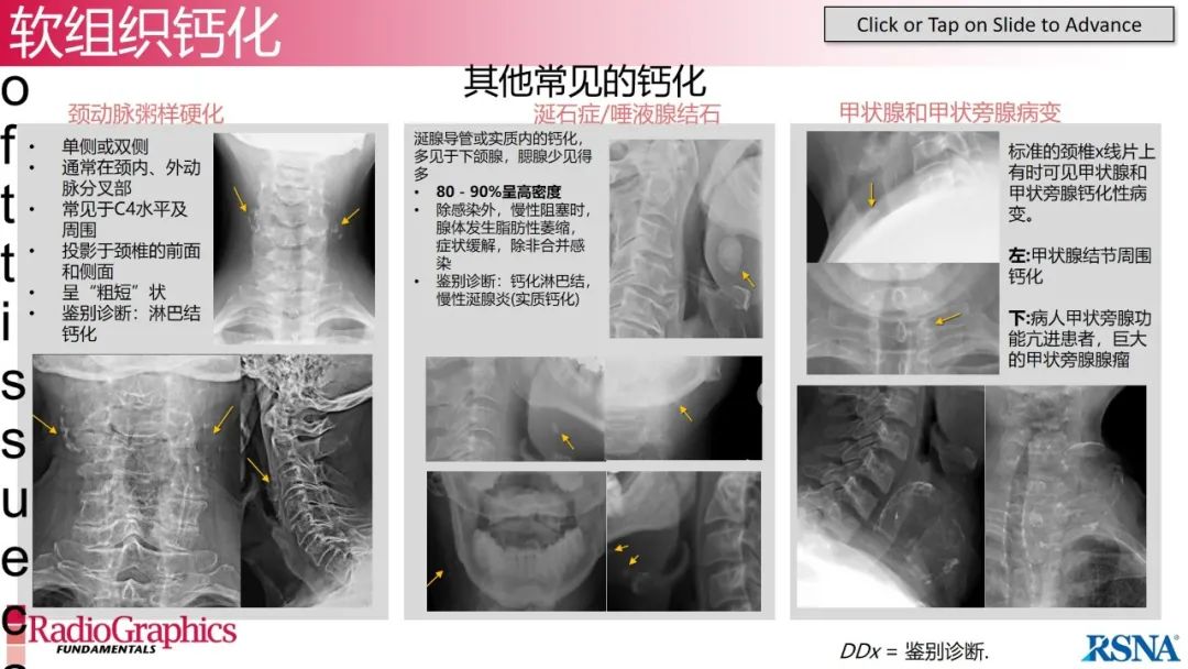 影像PPT - 【PPT】颈椎X线片解读-113 影像PPT - 【PPT】颈椎X线片解读-113