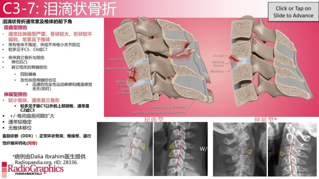 影像PPT - 【PPT】颈椎X线片解读-101 影像PPT - 【PPT】颈椎X线片解读-101