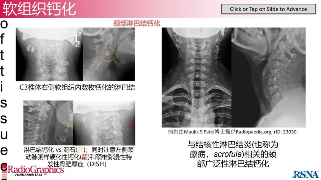 影像PPT - 【PPT】颈椎X线片解读-117 影像PPT - 【PPT】颈椎X线片解读-117