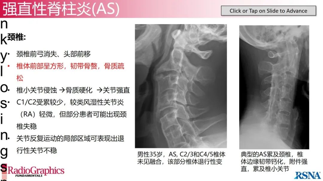 影像PPT - 【PPT】颈椎X线片解读-119 影像PPT - 【PPT】颈椎X线片解读-119