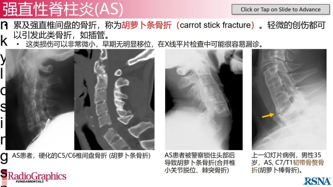 影像PPT - 【PPT】颈椎X线片解读-121 影像PPT - 【PPT】颈椎X线片解读-121