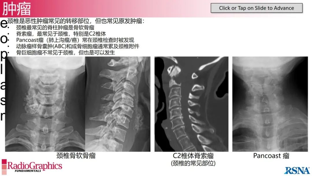 影像PPT - 【PPT】颈椎X线片解读-123 影像PPT - 【PPT】颈椎X线片解读-123