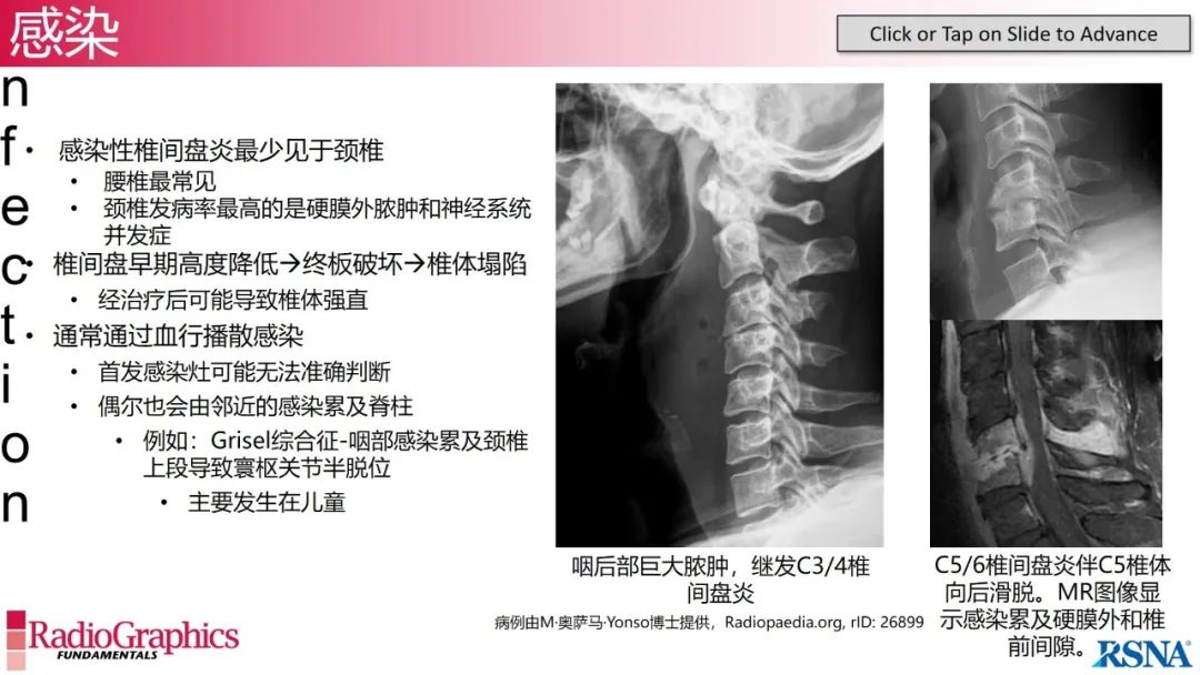 影像PPT - 【PPT】颈椎X线片解读-131 影像PPT - 【PPT】颈椎X线片解读-131