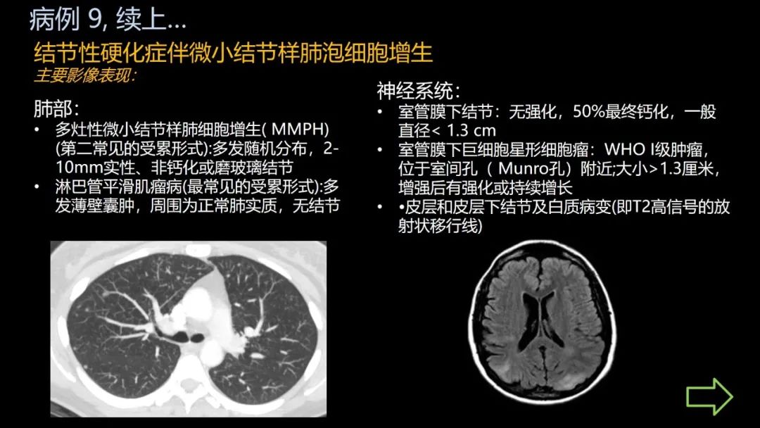 影像PPT - 【PPT】共通之处:同时累及中枢神经系统和心肺系统的疾病-57 影像PPT - 【PPT】共通之处:同时累及中枢神经系统和心肺系统的疾病-57